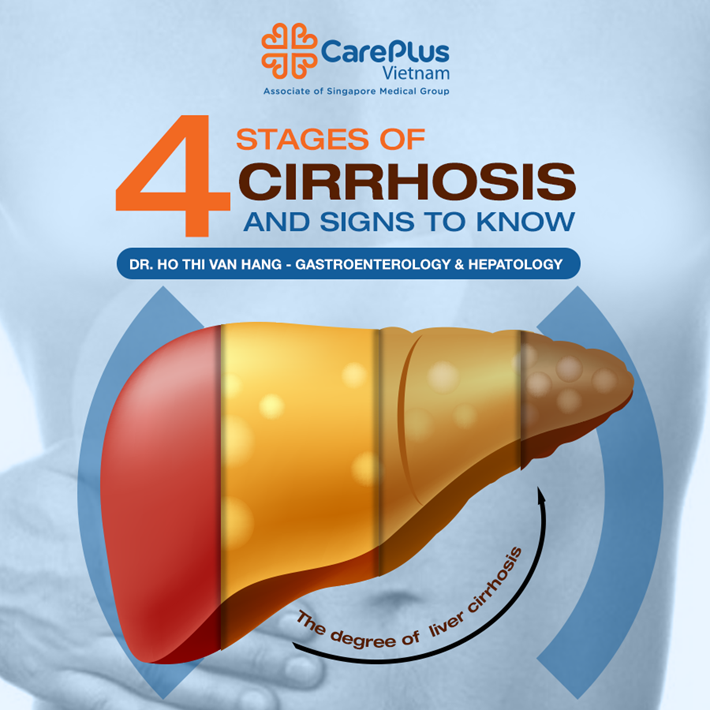 What Are The 4 Stages Of Cirrhosis Of The Liver: A Comprehensive Guide